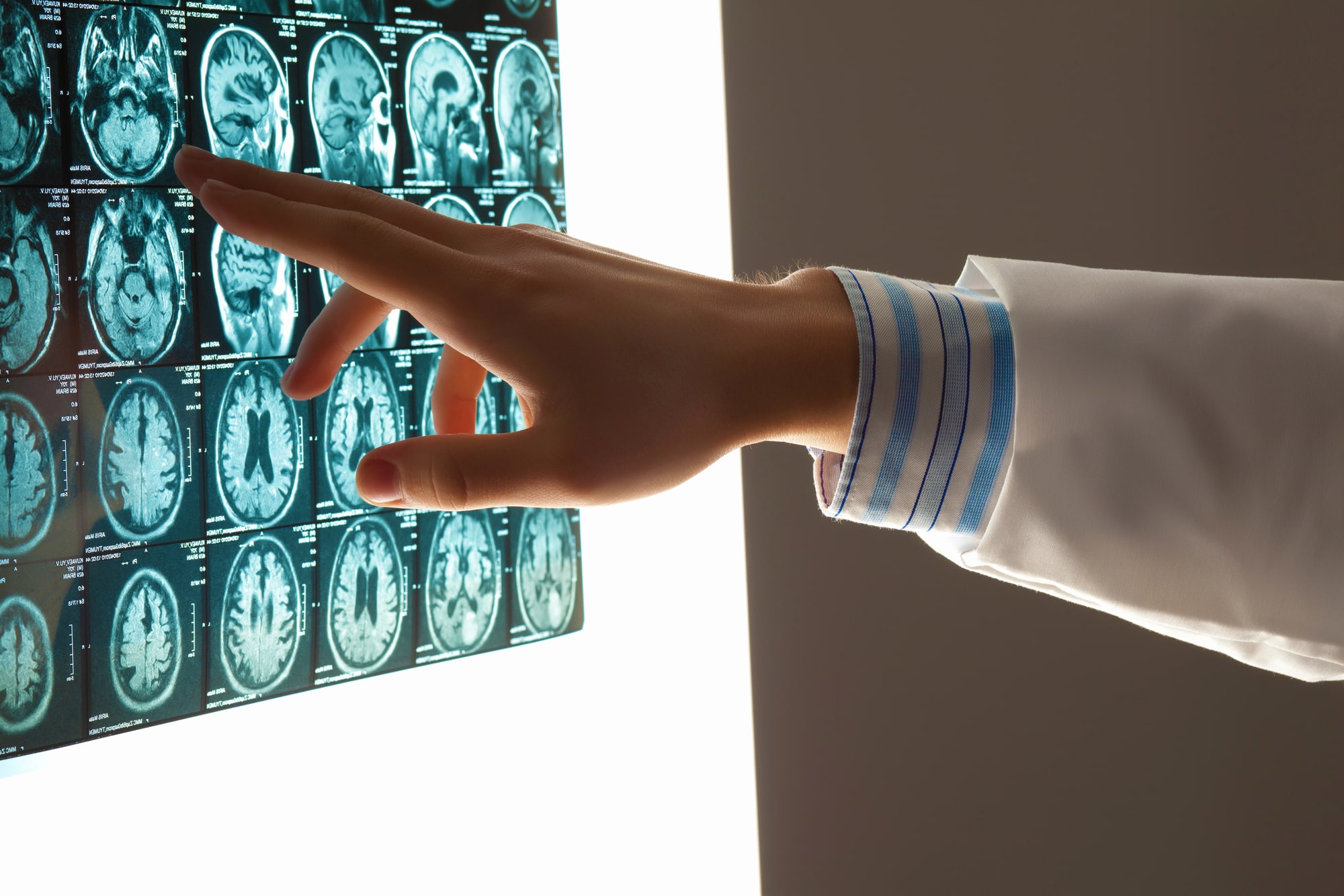 Common Types of Catastrophic Injuries in Alexandria, VA