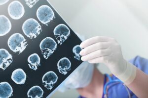 brain injury lawyer in Arlington, VA